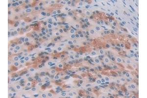 DAB staining on IHC-P; Samples: Rat Stomach Tissue (CCL17 antibody  (AA 27-93))