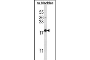 MYOG Antibody (N-term) (ABIN657743 and ABIN2846727) western blot analysis in mouse bladder tissue lysates (35 μg/lane). (Myogenin antibody  (N-Term))