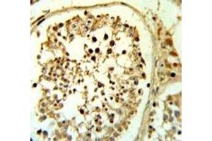 Fascin-3 antibody IHC analysis in formalin fixed and paraffin embedded human testis tissue. (Fascin 3 antibody  (AA 1-30))