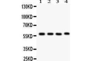 Western Blotting (WB) image for anti-Cytochrome P450, Family 1, Subfamily A, Polypeptide 1 (CYP1A1) (AA 183-320) antibody (ABIN3043819) (CYP1A1 antibody  (AA 183-320))
