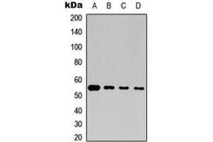 Western blot analysis of Beta-tubulin expression in Jurkat (A), K562 (B), mouse brain (C), rat brain (D) whole cell lysates.