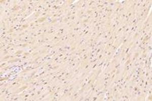 Immunohistochemistry analysis of paraffin-embedded mouse heart using,ZFP90 (ABIN7076275) at dilution of 1: 4200 (ZNF90 antibody)