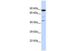 Image no. 1 for anti-RAD54-Like (RAD54L) (AA 216-265) antibody (ABIN6742672) (RAD54L antibody  (AA 216-265))