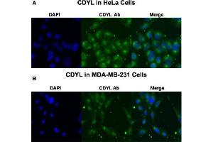 Immunofluorescent staining of HeLa (A) and MDA-MB-231 (B) cells with CDYL polyclonal antibody  at 4 ug/mL working concentration.