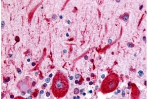 Anti-CELSR3 antibody  ABIN1048433 IHC staining of human brain, Purkinje neurons. (CELSR3 antibody  (N-Term))