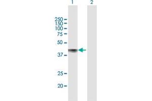 Western Blot analysis of CDCP1 expression in transfected 293T cell line by CDCP1 MaxPab polyclonal antibody. (CDCP1 antibody  (AA 1-343))