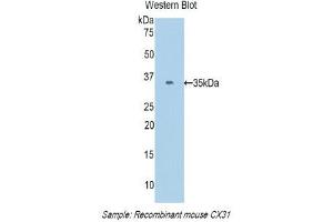 Western Blotting (WB) image for anti-Gap Junction Protein, beta 3, 31kDa (GJB3) (AA 213-270) antibody (ABIN1174652) (Connexin 31 antibody  (AA 213-270))
