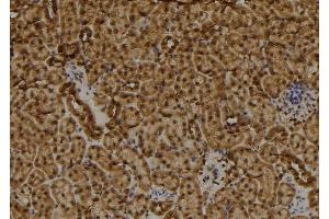 ABIN6257453 and ABIN6273496 at 1/100 staining Mouse kidney tissue by IHC-P. (RAD9B antibody  (C-Term))