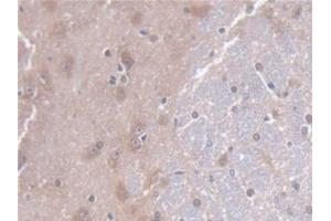 Detection of CD7 in Rat Cerebrum Tissue using Polyclonal Antibody to Cluster Of Differentiation 7 (CD7)