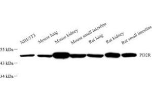 Western blot analysis of PD2R (ABIN7075206) at dilution of 1: 2000 (PTGDR antibody)