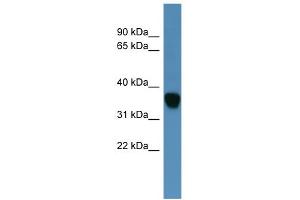 WB Suggested Anti-AKR1C1 Antibody Titration: 0.