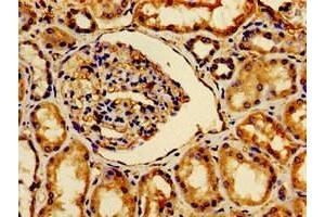 Immunohistochemistry of paraffin-embedded human kidney tissue using ABIN7175412 at dilution of 1:100