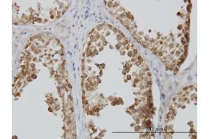 Immunoperoxidase of monoclonal antibody to DDX6 on formalin-fixed paraffin-embedded human testis. (DDX6 antibody  (AA 1-483))