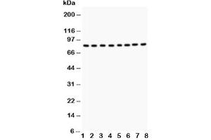 Western blot testing of BRAF antibody and Lane 1:  rat testis tissue;  2: rat brain tissue;  3: mouse testis tissue;  4: mouse brain tissue;  and human samples 5: HeLa;  6: Jurkat;  7: MCF-7;  8: K562