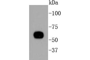 HeLa lysates, probed with Cytokeratin 10 (1D8) Monoclonal Antibody  at 1:1000 overnight at 4˚C.