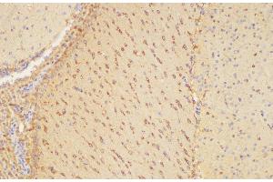 Immunohistochemistry of paraffin-embedded Mouse brain using PLAUR Ployclonal Antibody at dilution of 1:200. (PLAUR antibody)