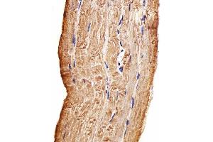 Paraformaldehyde-fixed, paraffin embedded Human skeletal muscle tissue, Antigen retrieval by boiling in sodium citrate buffer (pH6. (MAP4K3 antibody)