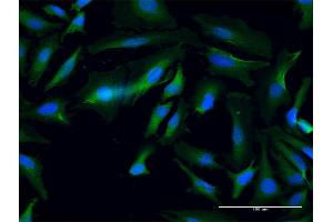 Immunofluorescence of purified MaxPab antibody to ANKMY1 on HeLa cell. (ANKMY1 antibody  (AA 1-720))