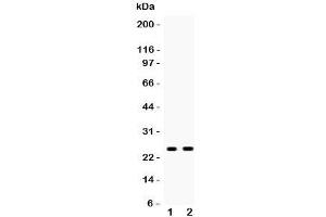 Western blot testing of PSCA antibody and Lane 1:  rat stomach;  2: mouse stomach;  Predicted size: 13KD;  Observed glycosylated size: up to 29KD