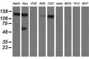 Western blot analysis of extracts (35 µg) from 9 different cell lines by using anti-L1CAM monoclonal antibody. (L1CAM antibody)