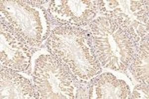 Immunohistochemistry analysis of paraffin-embedded mouse testis using,PSKH1 (ABIN7075291) at dilution of 1: 2800 (PSKH1 antibody)