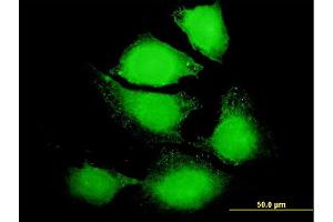 Immunofluorescence of purified MaxPab antibody to IL6 on HeLa cell. (IL-6 antibody  (AA 1-212))