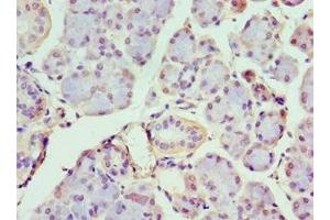 Immunohistochemistry of paraffin-embedded human pancreatic tissue using ABIN7156650 at dilution of 1:100 (IFIH1 antibody  (AA 1-205))