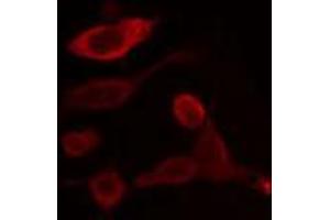 ABIN6266956 staining HeLa cells by IF/ICC. (CYP2U1 antibody  (Internal Region))