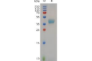 Cynomolgus Protein, hFc Tag on SDS-PAGE under reducing condition.
