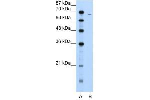 Fibrinogen Alpha antibody used at 5 ug/ml to detect target protein. (FGA antibody  (N-Term))