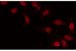 ABIN6266889 staining COLO205 by IF/ICC. (GTF2H2 antibody  (N-Term))