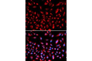 Immunofluorescence analysis of U2OS cells using CLDN11 antibody (ABIN5971415). (Claudin 11 antibody)