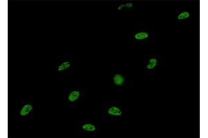 Immunofluorescence of monoclonal antibody to SNRPA on HeLa cell.