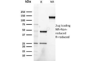 SDS-PAGE Analysis Purified Heregulin-1 Mouse Monoclonal Antibody (NRG1/2752). (Neuregulin 1 antibody  (AA 21-242))