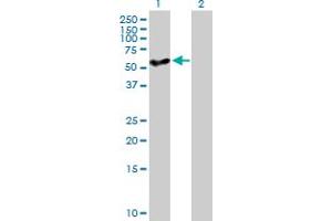 Western Blot analysis of CYP27A1 expression in transfected 293T cell line by CYP27A1 MaxPab polyclonal antibody. (CYP27A1 antibody  (AA 1-531))