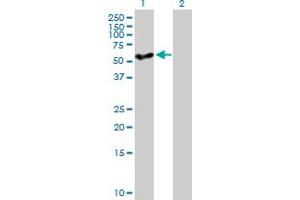 Western Blot analysis of CYP27A1 expression in transfected 293T cell line by CYP27A1 MaxPab polyclonal antibody. (CYP27A1 antibody  (AA 1-531))