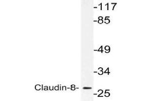 Western blot (WB) analysis of Claudin-8 antibody in extracts from Jurkat cells.