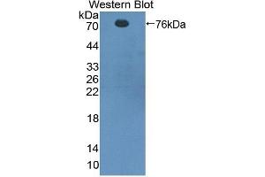 Detection of Recombinant CTTN, Rat using Polyclonal Antibody to Cortactin (CTTN) (Cortactin antibody  (AA 1-509))