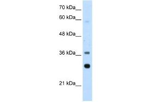 WB Suggested Anti-RPLP0 Antibody Titration:  2. (RPLP0 antibody  (Middle Region))