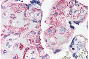 Human Placenta (formalin-fixed, paraffin-embedded) stained with C5AR1 antibody ABIN461687 followed by biotinylated goat anti-rabbit IgG secondary antibody ABIN481713, alkaline phosphatase-streptavidin and chromogen. (C5AR1 antibody  (Internal Region))