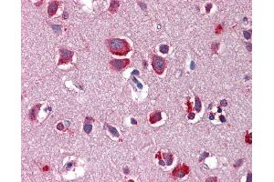 Immunohistochemistry (IHC) image for anti-Wingless-Type MMTV Integration Site Family, Member 7B (WNT7B) (AA 215-264) antibody (ABIN6747068)