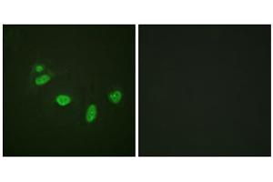 Immunofluorescence analysis of HeLa cells, using ETS1 (Phospho-Thr38) antibody.