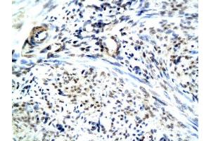 Formalin-fixed and paraffin embedded human uterine endomysium labeled with Anti-RAMP1 Polyclonal Antibody, Unconjugated (ABIN731438) followed by conjugation to the secondary antibody and DAB staining (RAMP1 antibody  (AA 118-148))