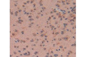 Used in DAB staining on fromalin fixed paraffin- embedded brain tissue (Calpain 5 antibody  (AA 26-343))
