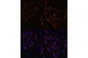 Immunofluorescence analysis of C6 cells using SUCLG2 Polyclonal Antibody  at dilution of 1:100 (40x lens). (SUCLG2 antibody  (AA 50-300))