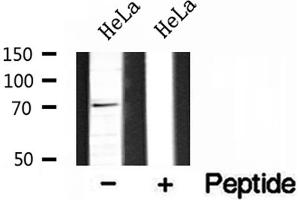 Western blot analysis of extracts of HeLa cells, using BRD7 antibody. (BRD7 antibody  (Internal Region))