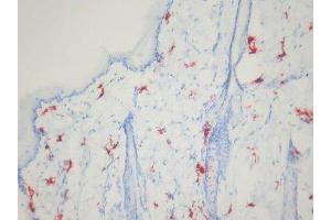 Immunohistochemistry (IHC) image for anti-Macrophages antibody (ABIN781726) (Macrophages antibody)