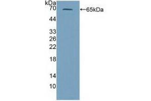Western blot analysis of recombinant Mouse PRF1. (Perforin 1 antibody  (AA 40-355))