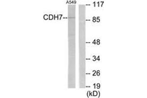 Western blot analysis of extracts from A549 cells, using CDH7 Antibody. (Cadherin 7 antibody  (AA 651-700))