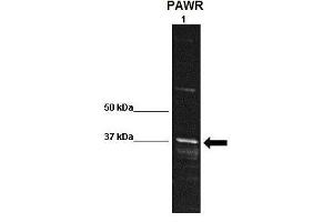 WB Suggested Anti-PAWR Antibody    Positive Control:  Lane 1: 30ug rat striatum homogenate  Primary Antibody Dilution :   1:1000  Secondary Antibody :  Anti rabbit-HRP   Secondry Antibody Dilution :   1:10,000  Submitted by:  Kristy Shimp, University of Florida (PAWR antibody  (Middle Region))